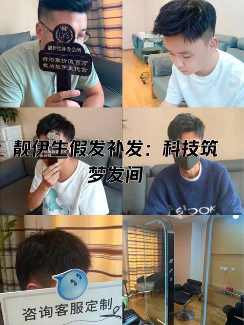 爱心假发：为脱发人群带来温暖与自信，助力重新融入生活