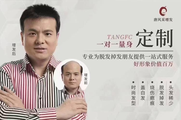 爱心假发：凝聚温暖与力量，助力脱发人士重拾自信