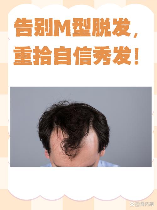 爱心假发：源于捐赠者头发，助脱发者重拾自信，多方面详尽介绍
