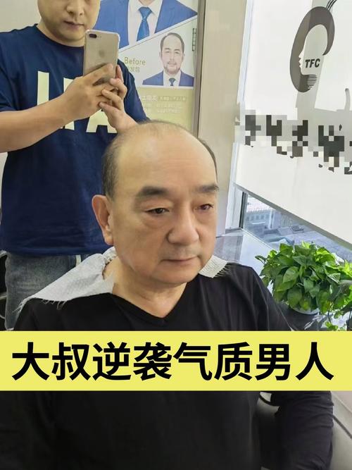 爱心假发：为因疾病脱发者带来希望，重塑自信的关键所在