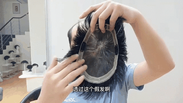 爱心假发：汇聚众人善意，助脱发者重拾自信的公益礼物