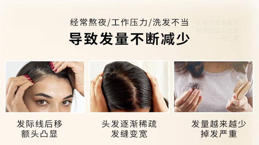 捐献头发用途大！助脱发人士重塑形象，缓解心理负担