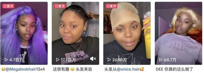 爱心假发：承载各界善意，为脱发人群带来希望与关怀